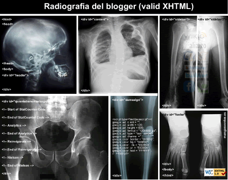 radiografía del blogger (valid xhtml)